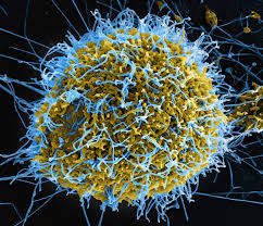 Again, Another Non-Nigerian Brings Ebola into Abuja; FG Says Don’t Panic, Stay Vigilant – THISDAYLIVE